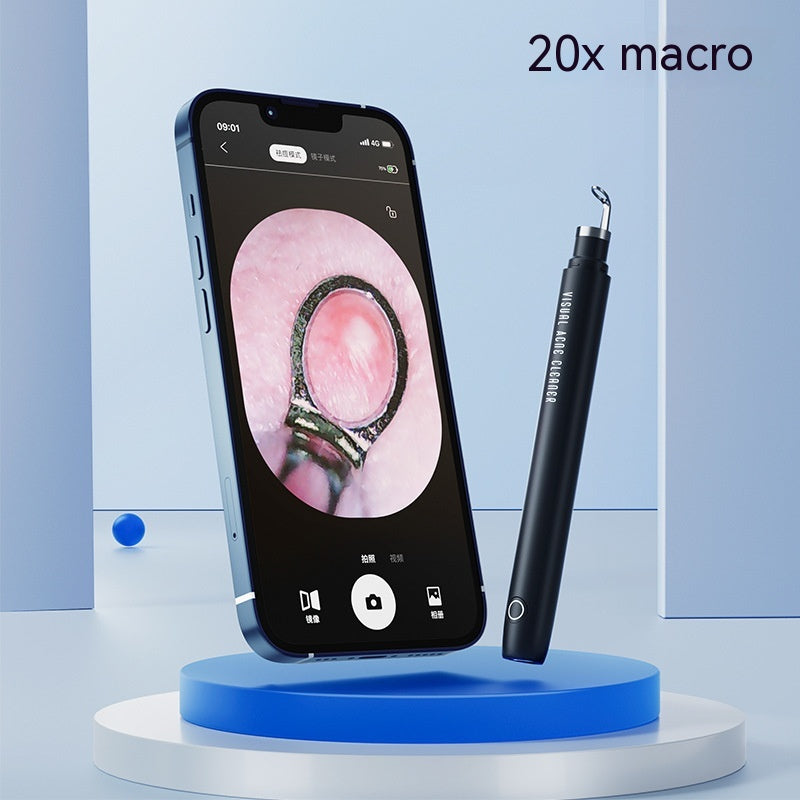 Su Nuoke Vision Pimple Pin M5 Blackhead Remover Black Cleansing Beauty Face Removal Pimples Tools