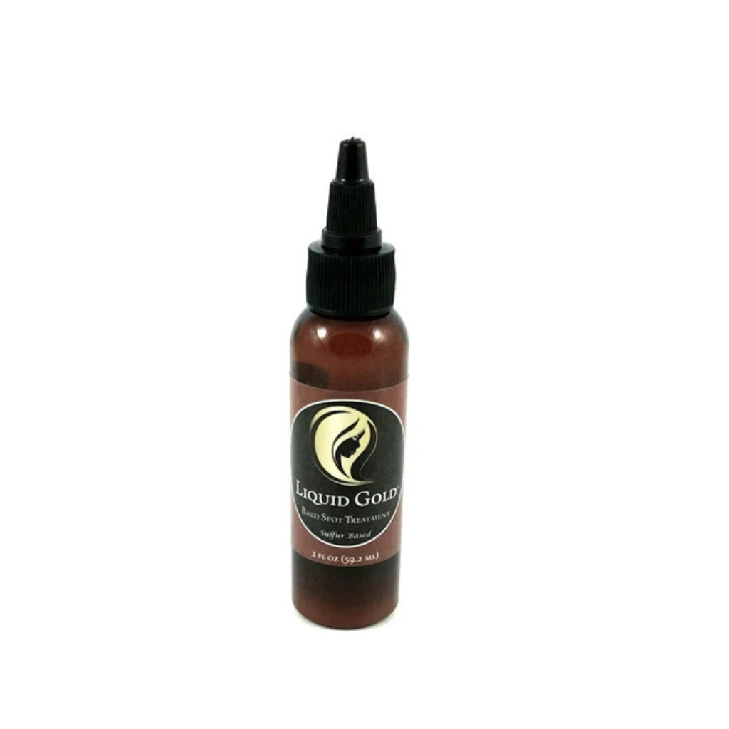 Liquid Gold Bald Spot Treatment – Targeted Sulfur Scalp Treatment