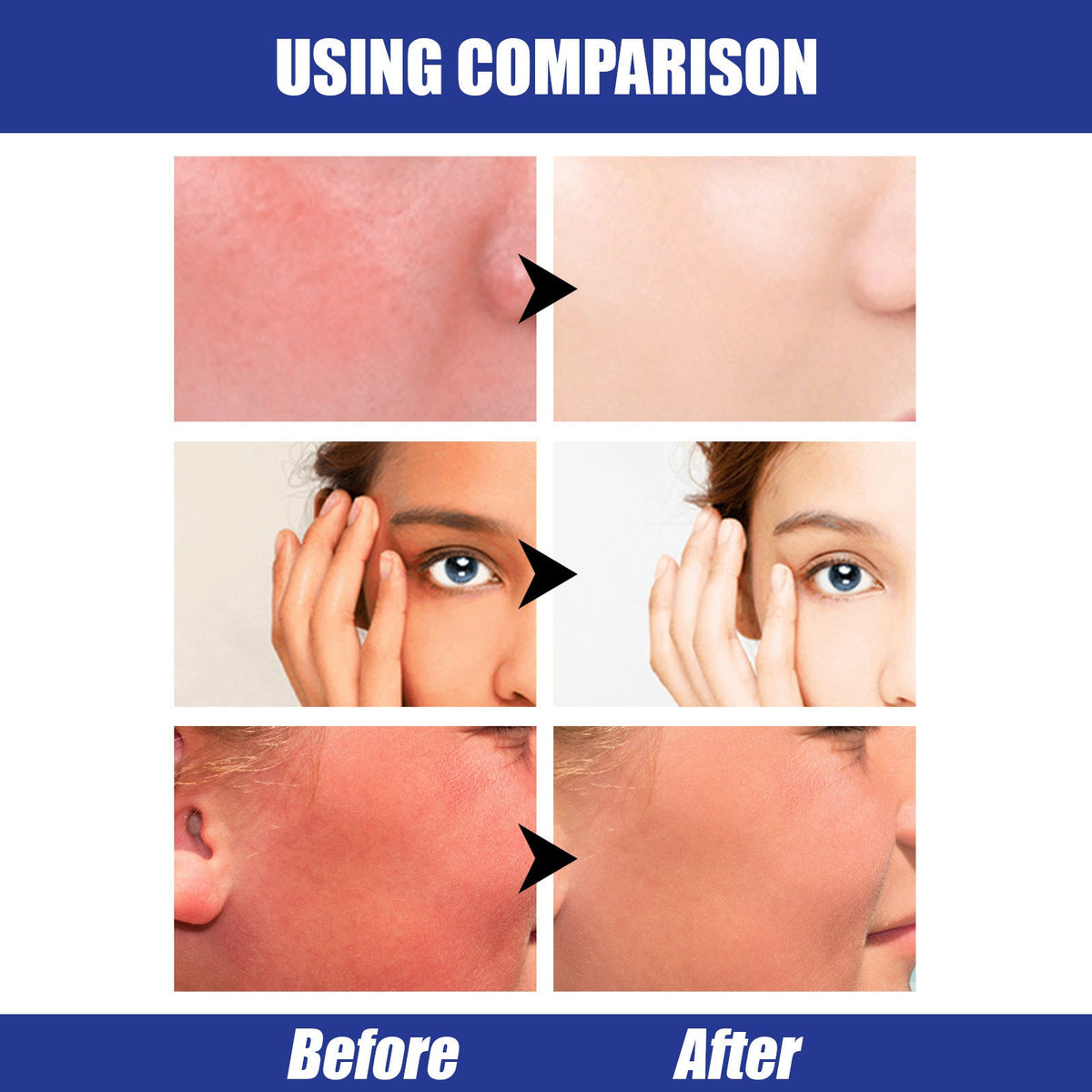 Lightweight SPF50 Hyaluronic Sunscreen Stick