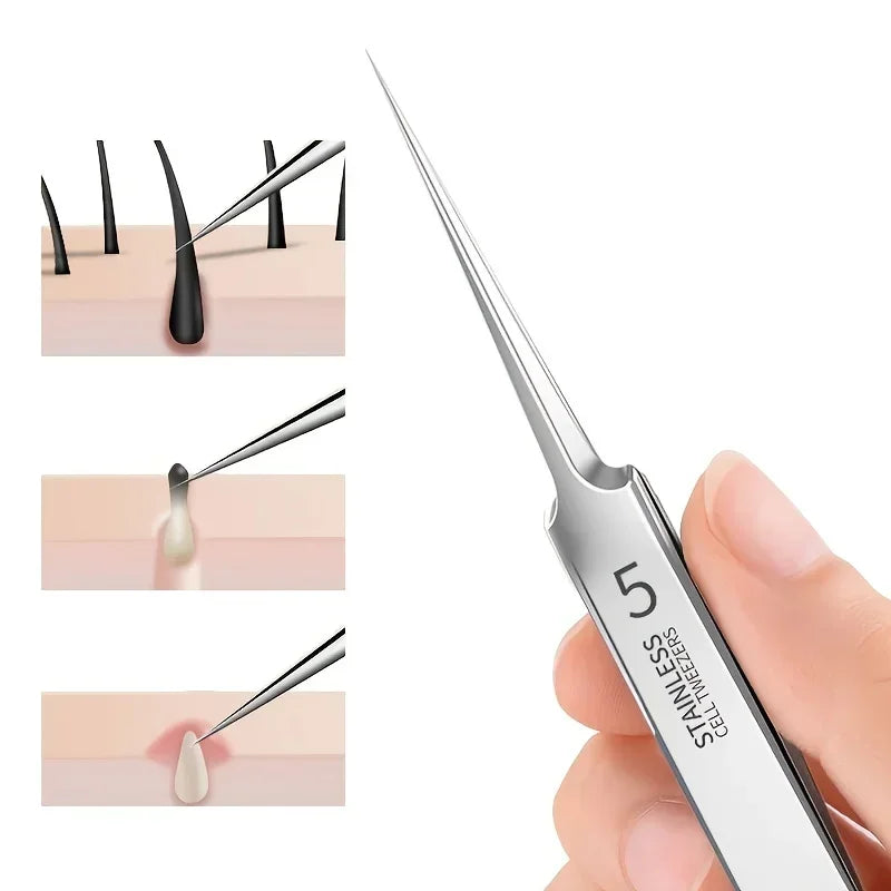 German 1/3/8Pack Extra Fine No. 5 Cellular Acne Blackhead Tweezers - Facial Beauty Remove Acne Needle Tools for Skin Care Tools