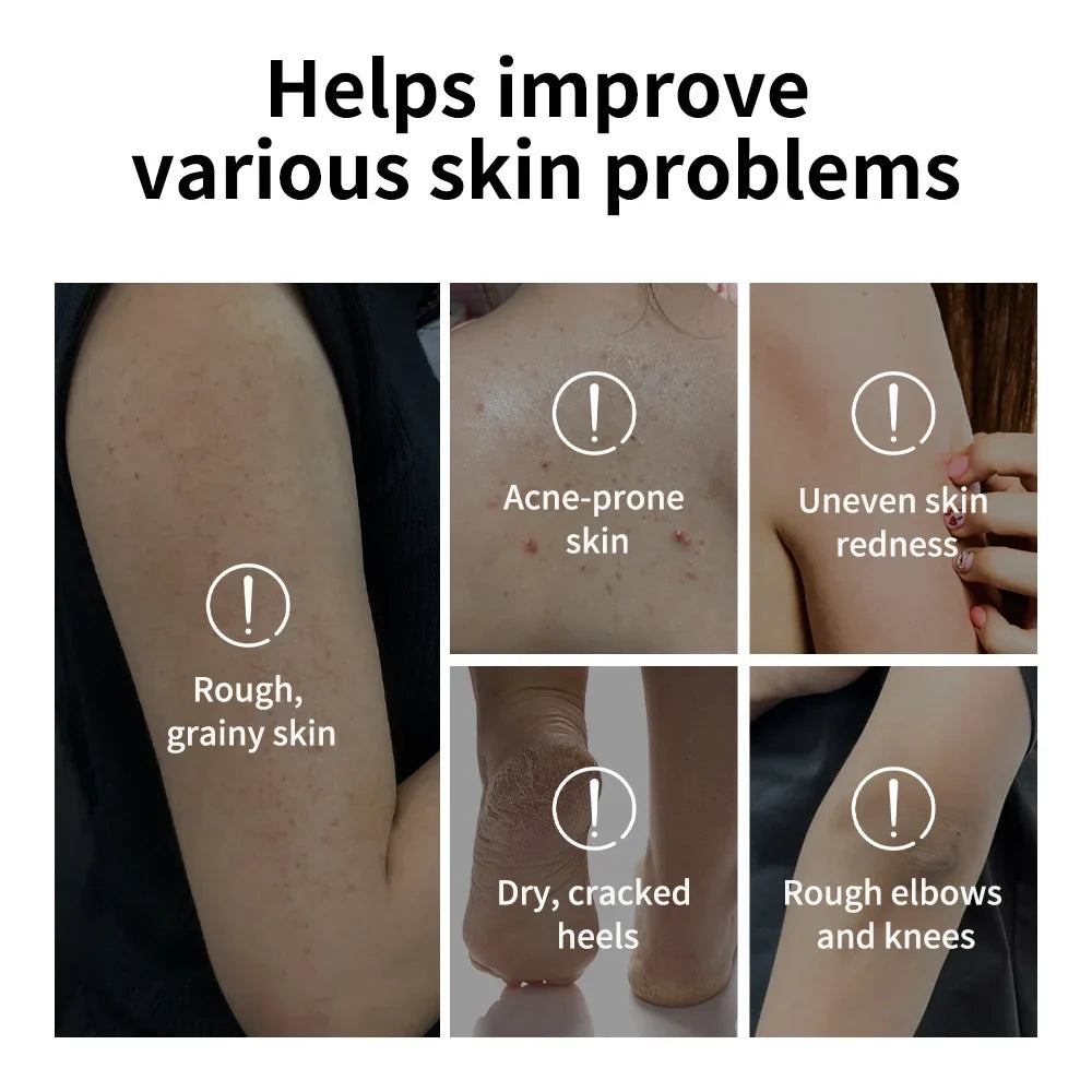 Glycolic Acid Exfoliating Body Stick Multiple Concerns Delivers Deep Effective Exfoliation Nourishing Moisture Deep Hydration