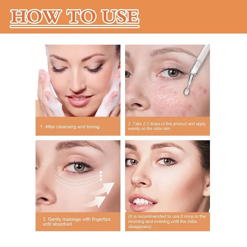 Fat Granules Removal Eye Serum Eye Milia Repair Treatment Products Wrinkle Lifting Moisturizing Anti-Puffiness Korean Skin Care