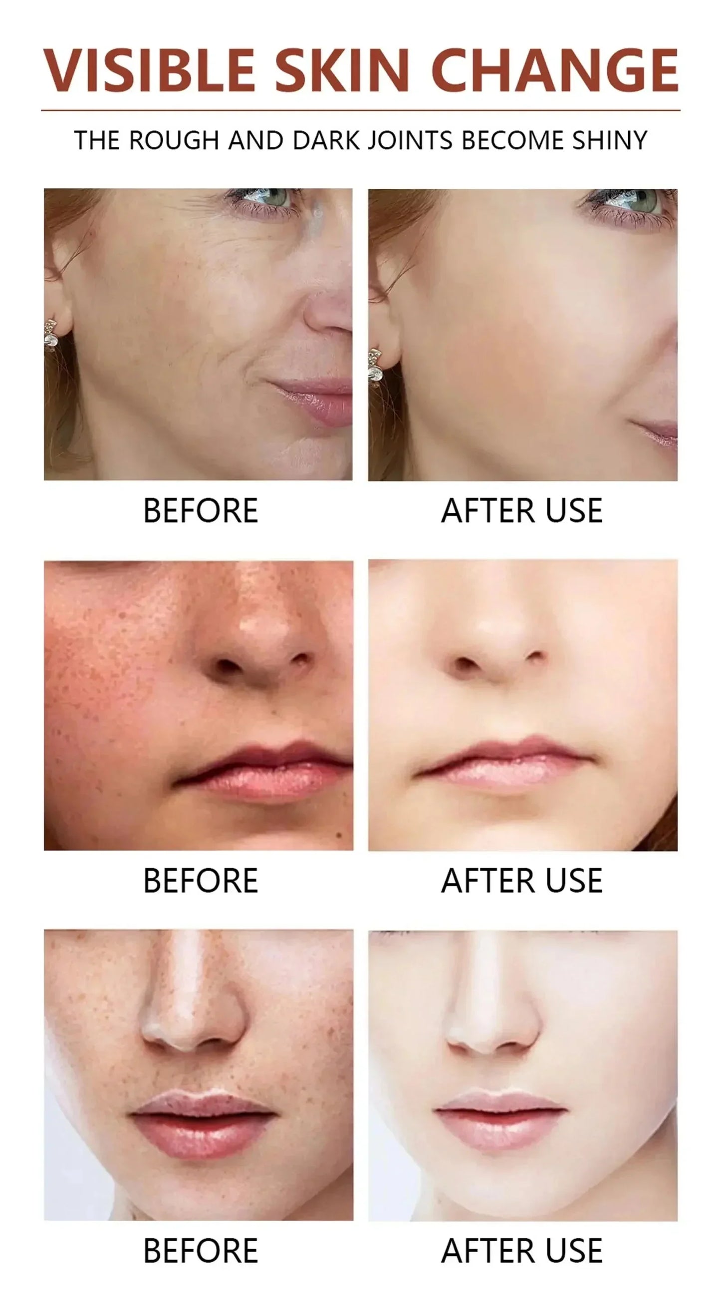 Acid Peeling Serum Chemical Exfoliant Peel For Remove Face Dark Skin Spots Whiten Lighten Melanin Peeling Solution Skin Peel