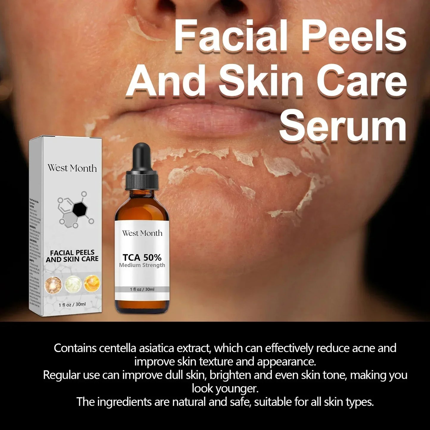 Acid Peeling Serum Chemical Exfoliant Peel For Remove Face Dark Skin Spots Whiten Lighten Melanin Peeling Solution Skin Peel