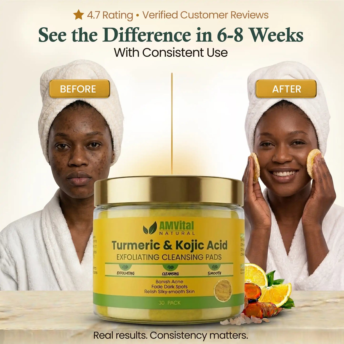 AMVital Turmeric Kojic Acid Cleansing Pads
