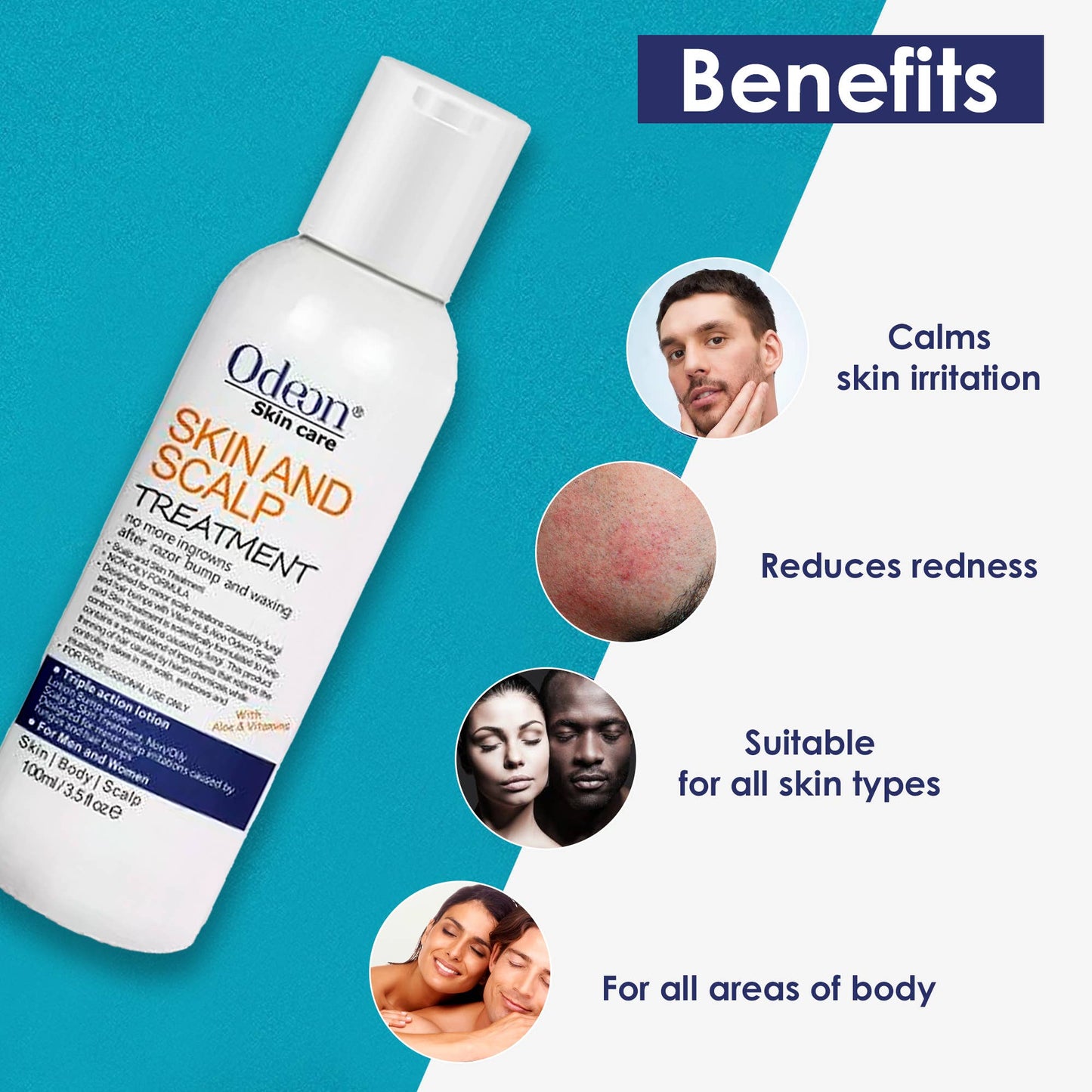 Odeon Skin & Scalp Treatment, 3.5 Oz