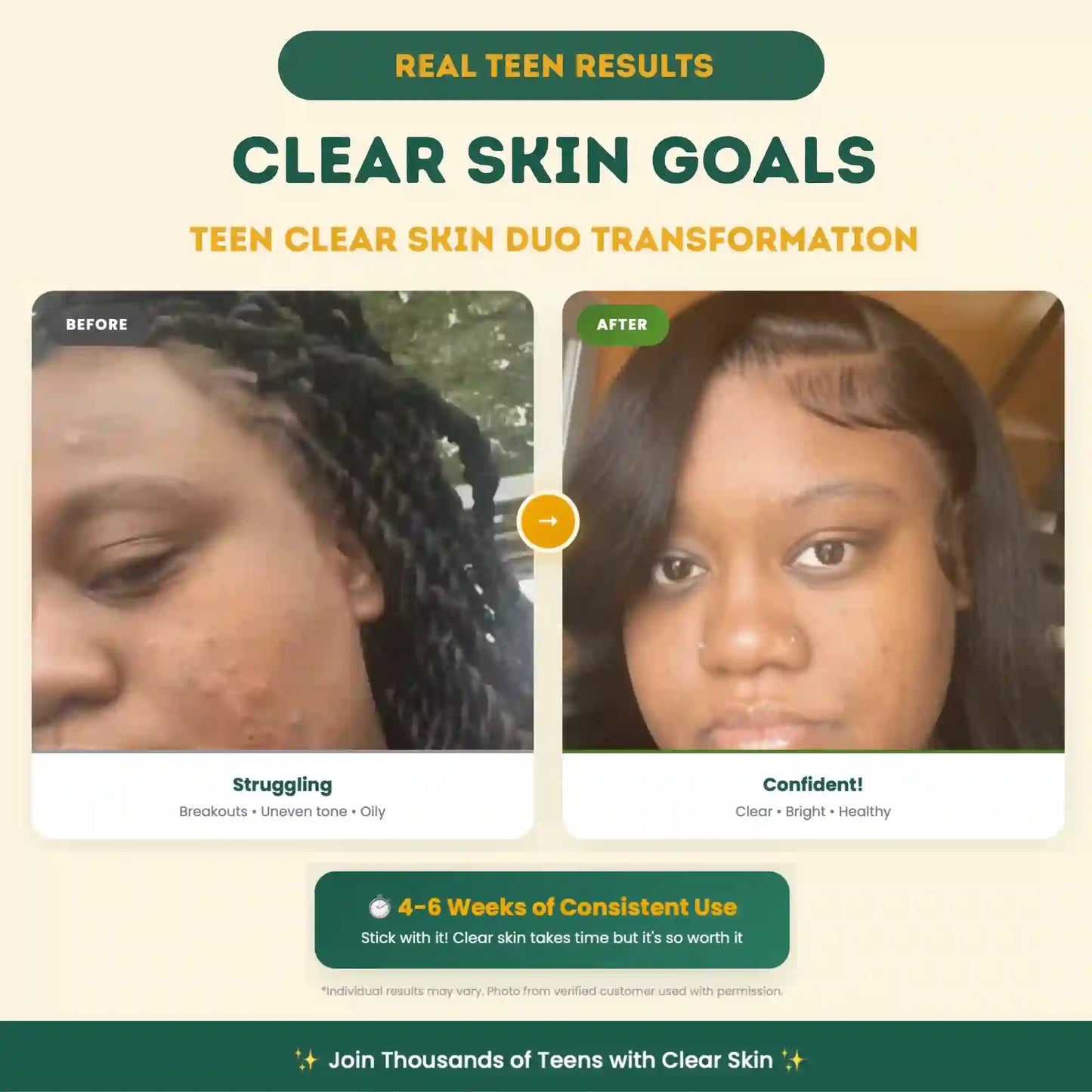 Teen Clear Skin Duo