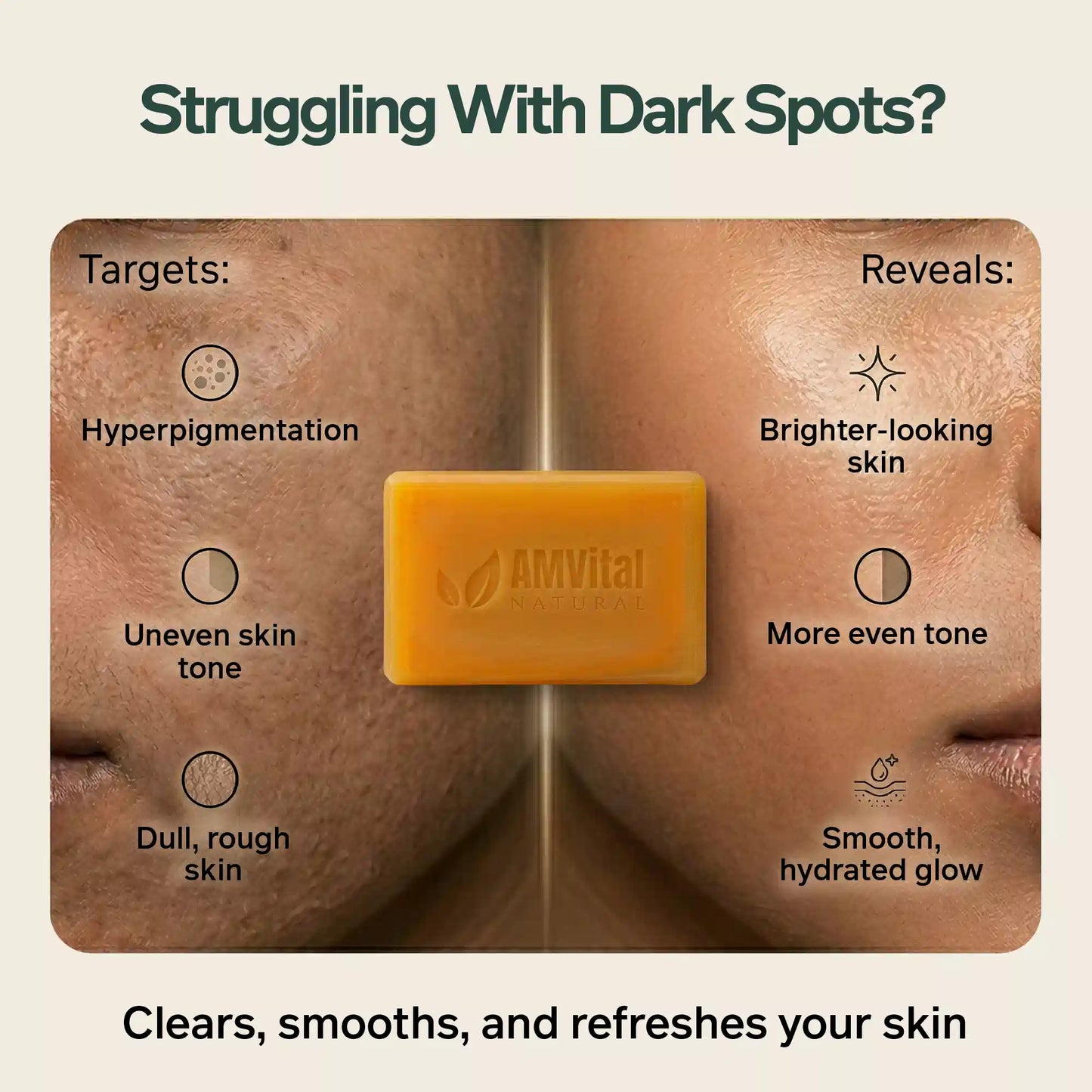 AMVital Turmeric Kojic Acid Soap Bar for Dark Spots & Uneven Tone